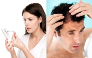 Tóc rụng nhiều phải làm sao?